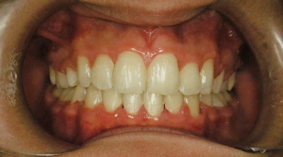 Premena ffe2353b-27b8-4353-97f4-680540274e45 — po