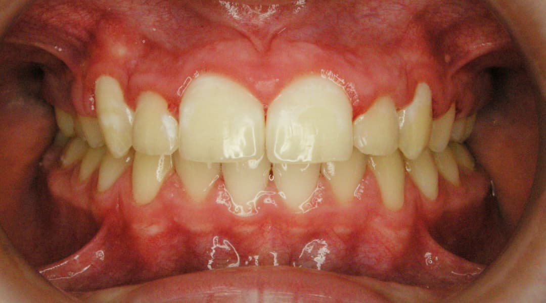 Premena bbd55ba5-b37e-436a-ad81-ca4a16520585 — po