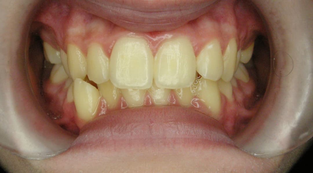 Premena 5e9fd298-6f42-4e0c-a1a8-292c5abc59a2 — po